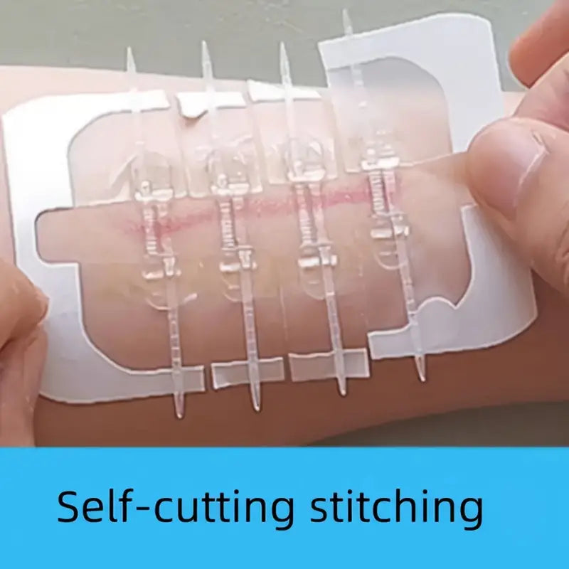 2pcs Elastic Bandage Wraps With Secure Buckle Closure - Little Tokyo SA